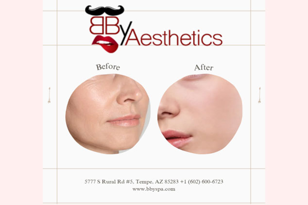 Side-by-side comparison of a woman's lower face showing "Before" with wrinkles and "After" with smoother skin under the logo "BBY Aesthetics & BBY Spa," plus contact information below.