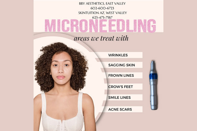 Woman standing next to a list of skin concerns treated by microneedling, including wrinkles, sagging skin, frown lines, crow's feet, smile lines, and acne scars. Microneedling device shown.